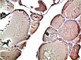 TTR Monoclonal Antibody