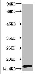 TTR Monoclonal Antibody
