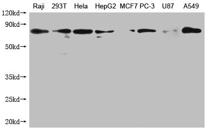 Hsp70(HSPA1A) Monoclonal Antibody