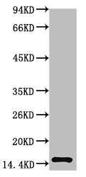 TTR Monoclonal Antibody