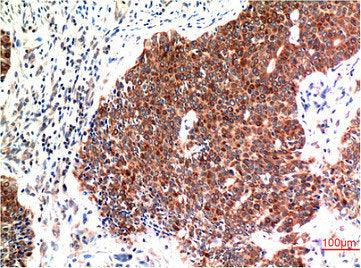 BECN1 Monoclonal Antibody
