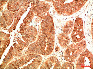 Acetyl-TP53(K382) Monoclonal Antibody