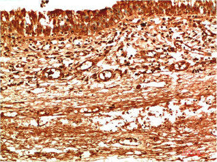 TTR Monoclonal Antibody