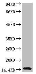 TTR Monoclonal Antibody