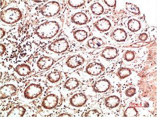 COL2A1 Monoclonal Antibody