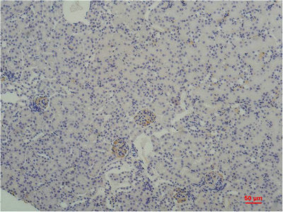 TBP Monoclonal Antibody