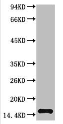 TTR Monoclonal Antibody
