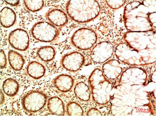 Acetyl-TP53(K382) Monoclonal Antibody