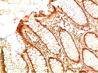 Acetyl-TP53(K382) Monoclonal Antibody
