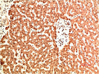 COL4A1 Monoclonal Antibody
