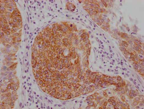 KRT14 Monoclonal Antibody