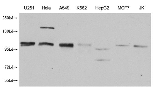 MBTPS1 Monoclonal Antibody
