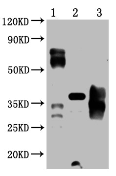 PD-1 Monoclonal Antibody