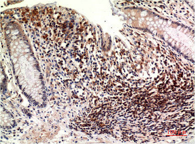 TUBE1 Monoclonal Antibody