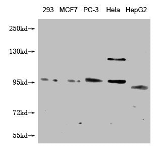 FILIP1L Monoclonal Antibody