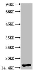 TTR Monoclonal Antibody