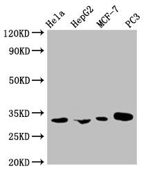 AGBL2 Monoclonal Antibody