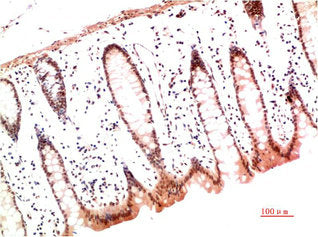 COL1A1 Monoclonal Antibody