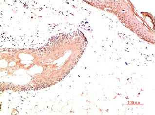 COL1A1 Monoclonal Antibody