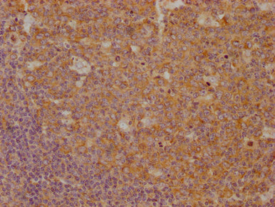 TUBA1A Monoclonal Antibody