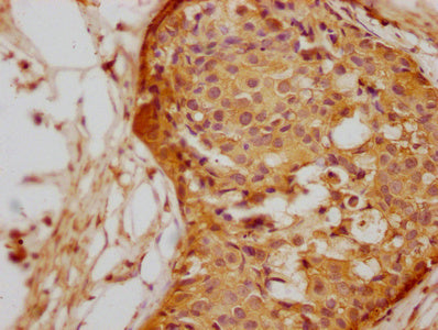 TUBA1A Monoclonal Antibody