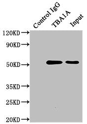 TUBA1A Monoclonal Antibody
