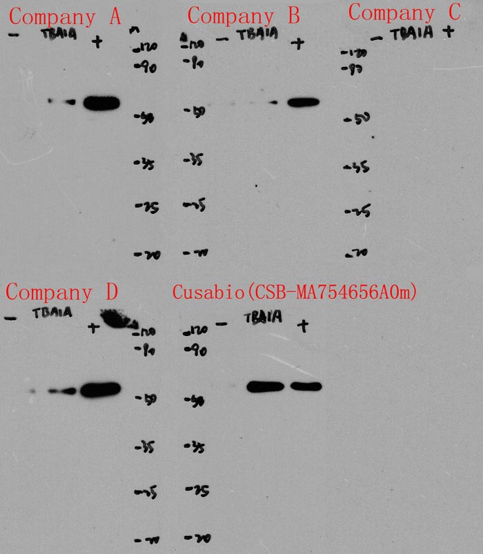 TUBA1A Monoclonal Antibody