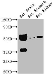 TUBA1A Monoclonal Antibody