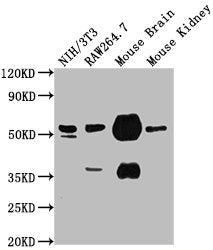TUBA1A Monoclonal Antibody