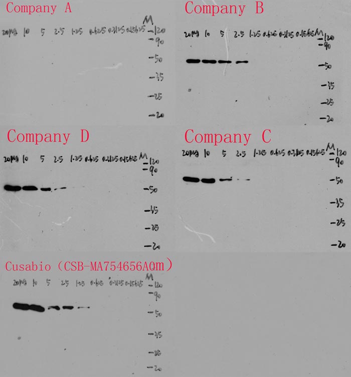 TUBA1A Monoclonal Antibody