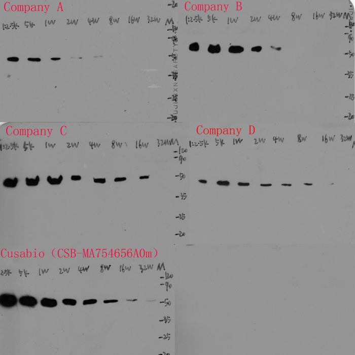 TUBA1A Monoclonal Antibody