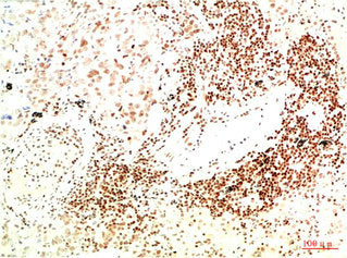 JAK2 Monoclonal Antibody