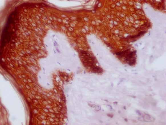 KRT14/KRT16/KRT5/KRT6A/KRT8 Monoclonal Antibody