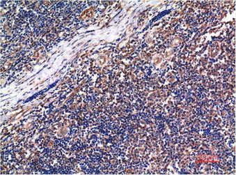 CCNB1 Monoclonal Antibody