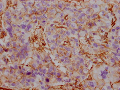 ACTB/POTEKP/ACTG1 Monoclonal Antibody