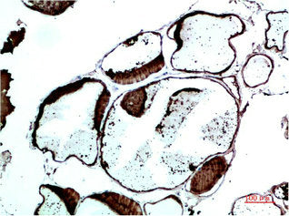 TTR Monoclonal Antibody