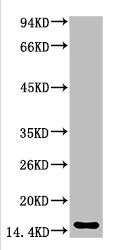 TTR Monoclonal Antibody
