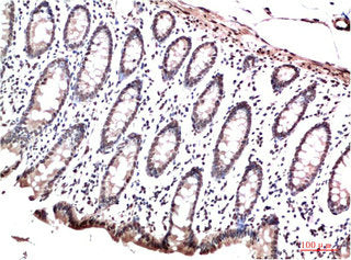 CBX3 Monoclonal Antibody