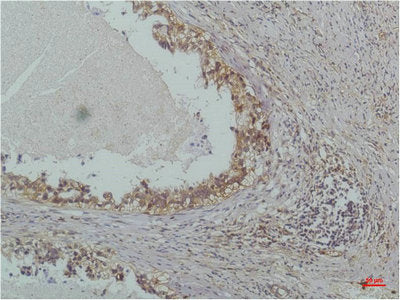 NFKBIB Monoclonal Antibody