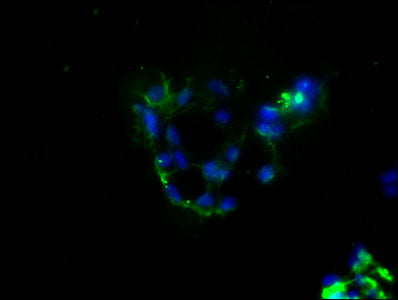 PD-L1 Monoclonal Antibody