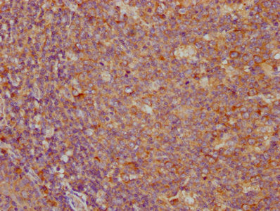 PD-L1 Monoclonal Antibody