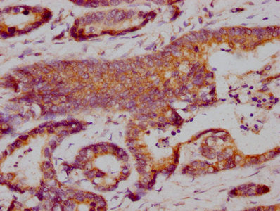 PD-L1 Monoclonal Antibody