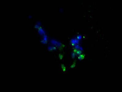 PD-L1 Monoclonal Antibody