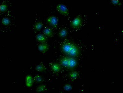 PD-L1 Monoclonal Antibody