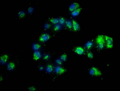 PD-L1 Monoclonal Antibody