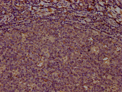 PD-L1 Monoclonal Antibody