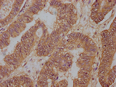PD-L1 Monoclonal Antibody