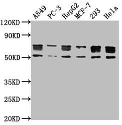 PD-L1 Monoclonal Antibody