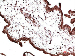 CBX3 Monoclonal Antibody