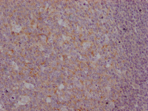 CR2 Monoclonal Antibody